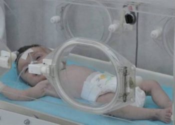 عمليات قيصرية لنساء مصابات بكورونا بمستشفي الولادة امدرمان .. واحتواء حريق