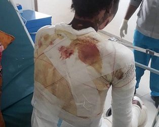 مقتل سوداني حرقا علي يد عصابات اتجار بالبشر في ليبيا