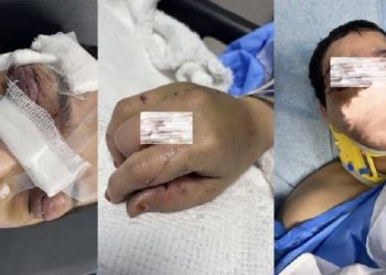 توقيف زوج اعتدى بالضرب بوحشية على زوجته