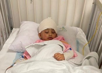 كلاب ضالة تستدرج طفل وتنهشه