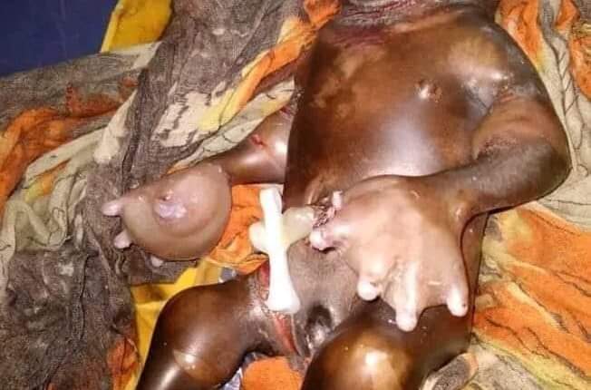 سبب استخدام المواد الكيمائية في التنقيب ولادة طفل مشوه بقرية في القضارف