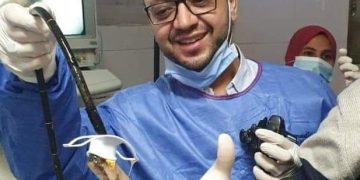 فريق طبي ينجح في  أستخراج “موبايل” من بطن شاب