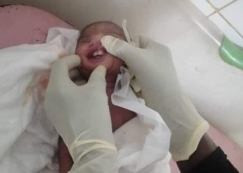 حالة ولادة نادرة  لطفل باسنانه  بالسودان
