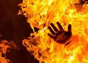 زوج يحرق زوجتة  بالبنزين